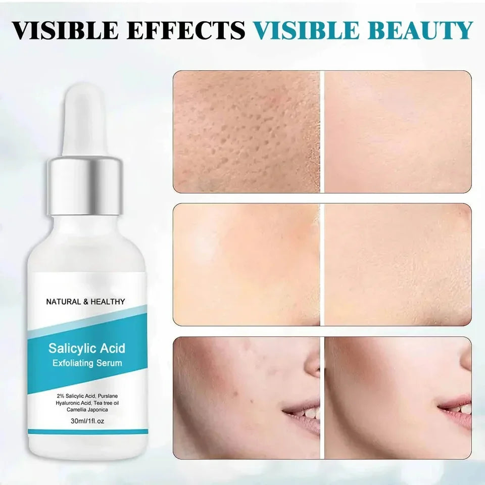 Facial Peel